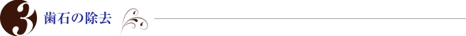3. 歯石の除去
